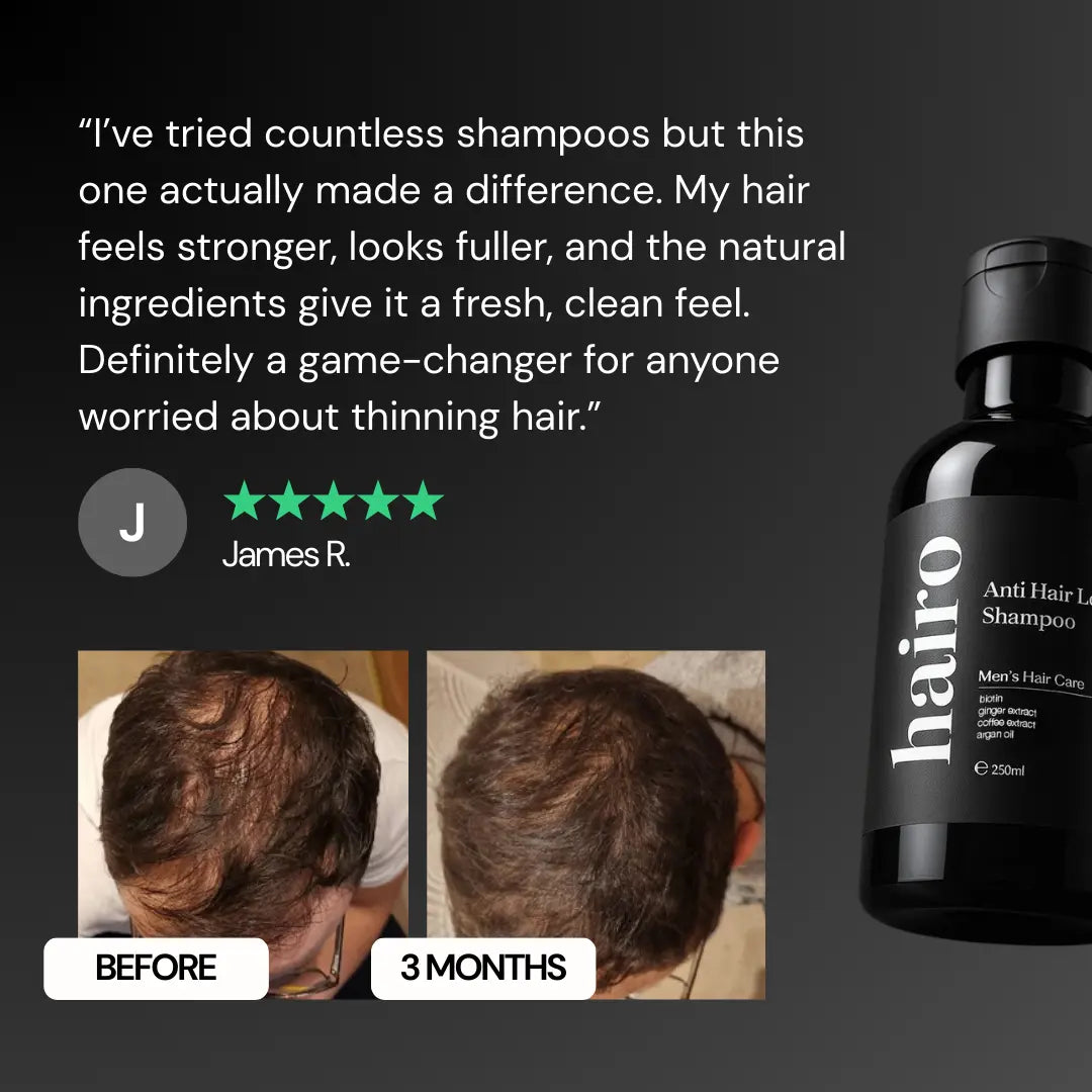 Anti Hair Loss Shampoo